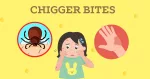 chigger-bites